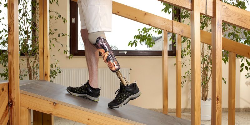 personal injury claim and prosthetic limbs napoli shkolnik