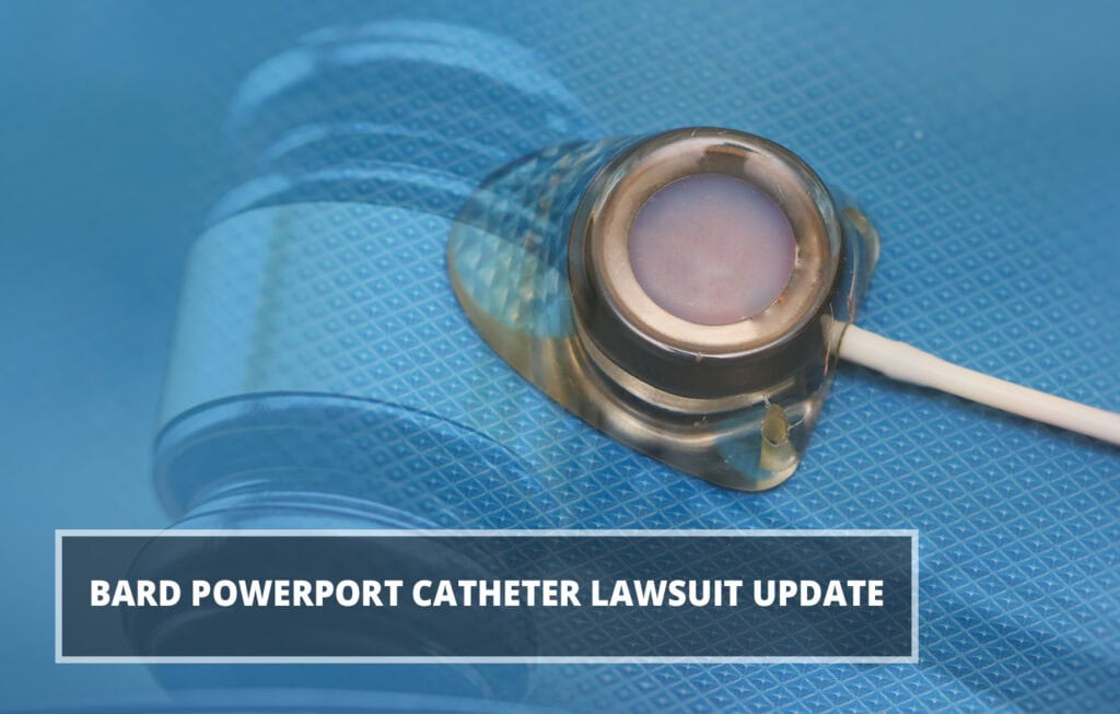 Bard PowerPort Catheter Lawsuit Update